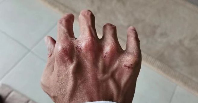 谢霆锋长年拍摄的手上布满受过伤的痕迹。(图/谢霆锋 IG)