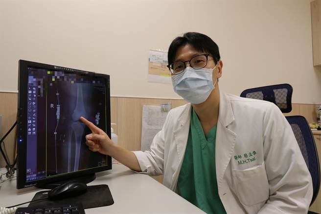 亚洲大学附属医院骨科主治医师蔡孟学指出，前十字韧带断裂就像是被扯断的麻绳松散，膝关节内关节腔的血会渗到周围，没有血肿也不会癒合，必须透过手术的方式进行治疗。（亚大医院提供／卢金足台中传真）