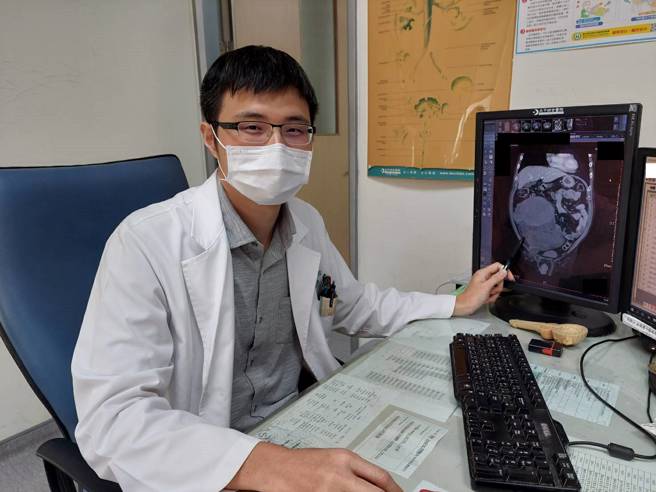 大千综合医院泌尿科医师李承哲表示，脂肪肉瘤常发生于四肢及后腹腔内，是深层软组织异常且具有侵犯性的恶性肿瘤，为罕见的癌症疾病。(李京升)