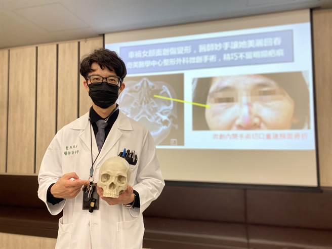 奇美医学中心整形外科主治医师许翰平表示，新式无痕内开切口微创手术，将疤痕藏在眼睑内层及嘴巴上方牙龈齿沟，可免于留下明显疤痕。(曹婷婷摄)