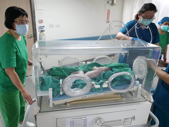 医护人员以剖腹方式产下3100克女婴，母婴均安。（南投县政府提供／张妍溱南投传真）