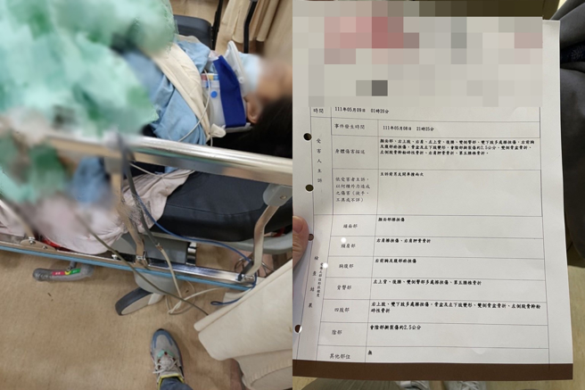 被害女子全身多處擦挫傷與骨折，後續還須經歷一連串的手術與復健。（翻攝自Dcard）