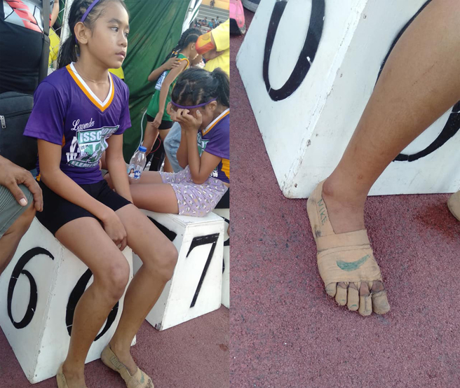女童因為沒錢買鞋，只好腳纏繃帶上場比田徑，最終奪下3面金牌，勵志故事不斷在網路上瘋傳。（圖片翻攝自FB/Predirick B. Valenzuela）