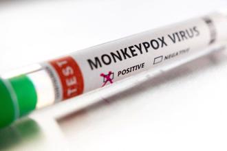 美加猴痘病例增加 芬蘭出現首例
