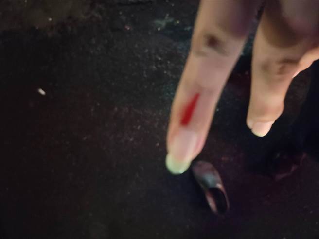 警方準備逮捕陳婦時，陳婦竟咬傷員警右手小拇指，警方將她逮捕，全案依妨害公務、傷害等罪嫌移送偵辦。(警方提供／林雅惠高雄傳真)