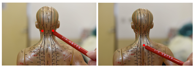 不少病人康復后仍会头痛，中医师建议透过按摩风池穴(图左)及大椎穴(图右)、来缓解。(图/恩主公医院提供)