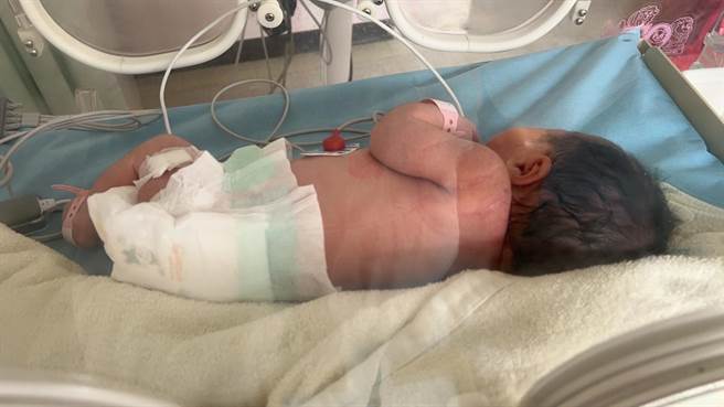 南投医院为确诊孕妇接生，母女均安。（南投县政府提供／廖志晃南投传真）