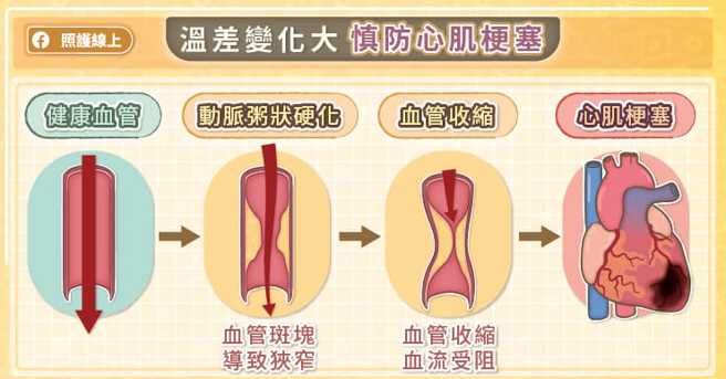 (图/照护线上提供)