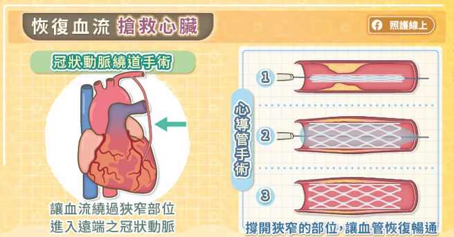(图/照护线上提供)