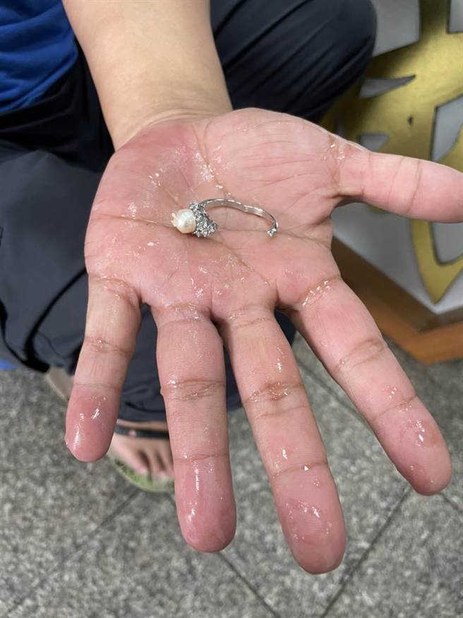 消防人员协助切断戒指，顺利「解套」。（金门县消防局提供）