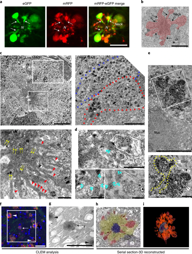 小鼠神經元內自噬空泡會在細胞核周圍出現類似花朵的環狀物，同時也發現細胞的溶酶體出現了酸性變化，影響了細胞自噬泡內代謝廢物的分解、清除和回收。圖為小鼠神經元花環狀物的超微結構表徵。（圖／Nature Neuroscience)