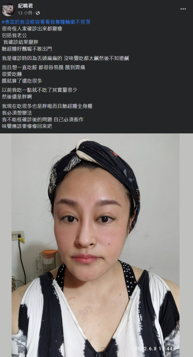 纪晓君确诊后食量大增，表示体重直线上升胖到不敢出门。(纪晓君脸书)