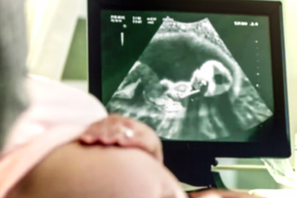 42歲女腹痛檢查發現懷孕 醫看超音波驚：寶寶踢掉避孕器