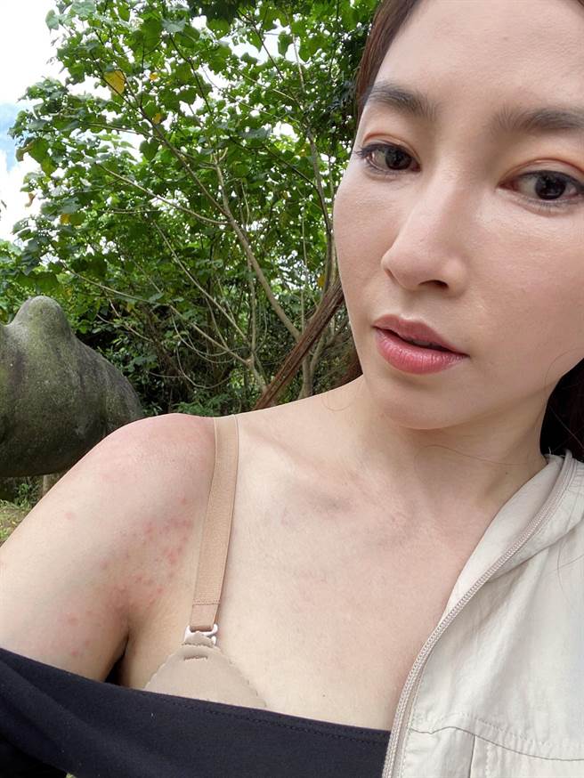 張家瑋外景拍攝，遇到毛毛蟲危機，引起過敏。（民視提供）