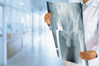 4大症狀是骨頭「空掉了」 醫曝：腸胃不適恐因骨質疏鬆 