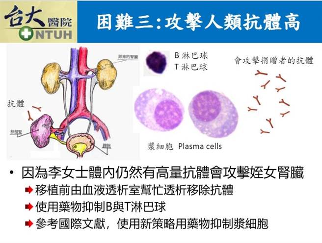 二次肾臟移植手术难度较高，因为第一次移植时会产生抗体，恐攻击二次移植的器官，术前须由血液透析移除抗体。（台大医院提供）