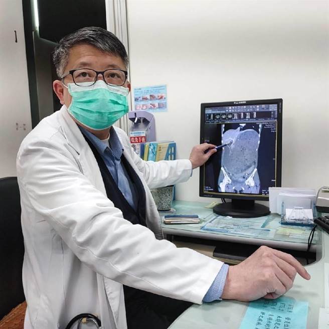 胃肠肝胆科林宗赐主任透过电脑断层影像，指出「上肠繫膜动脉症候群」患者十二指肠受压阻塞，导致胃部排空困难充满食靡。（卫福部苗栗医院提供／李京升苗栗传真）