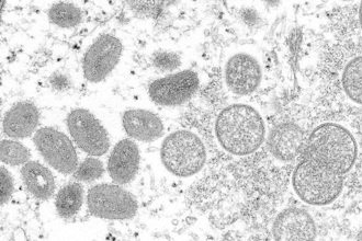 猴痘病毒爆一堆突變 科學家驚揭1趨勢
