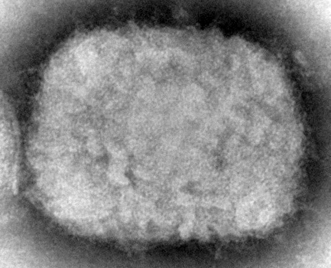世界卫生组织（WHO）25日定调，现阶段猴痘疫情还不构成「国际关注公共卫生紧急事件」。图为显微镜下的猴痘病毒粒子。（资料照／美联社、美国CDC）