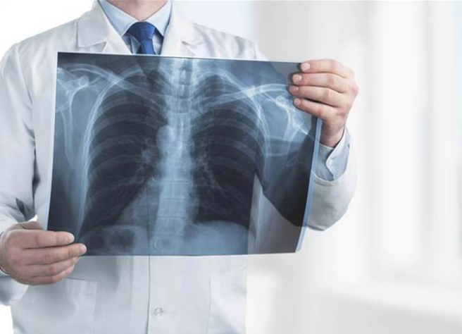 醫師指出，若家族中有人曾罹患肺癌，應注意與遺傳的關係，定期檢查。（示意圖／Shutterstock）