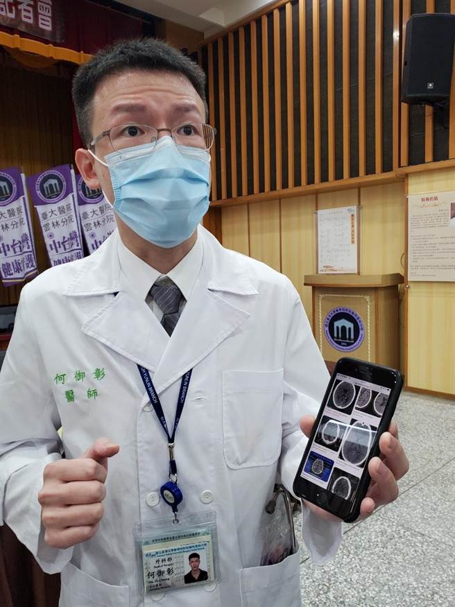 臺大雲林分院神經外科醫師何御彰在團隊成員及先進設備協助下，為女孩切除７公分腦瘤，未傷及任何神經，女孩2周後順利出院。（周麗蘭攝）