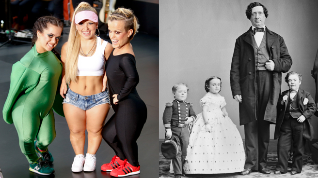 侏儒症指先天發育不良。(圖/達志影像，非當事人)