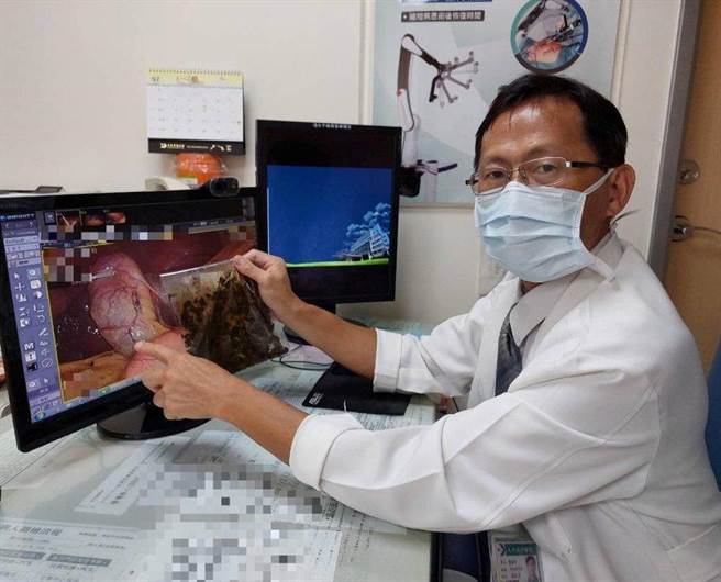 馮啟彥主任提醒，飯後若有不明原因的上腹痛，務必及早到醫院接受檢查。（大千醫院提供／李京昇苗栗傳真）