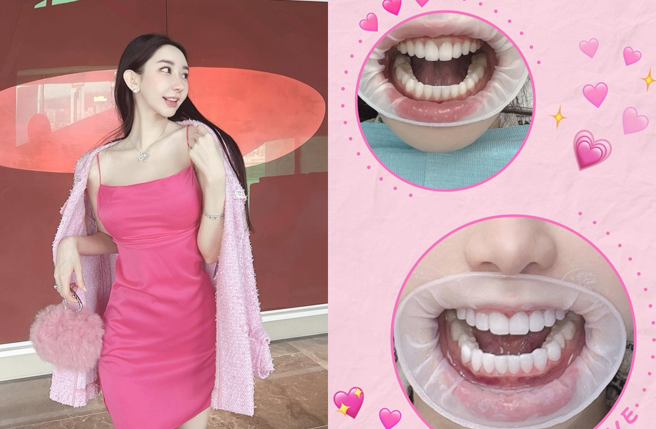 谢熙婷自曝整牙。（图／翻摄自cbbheree IG）