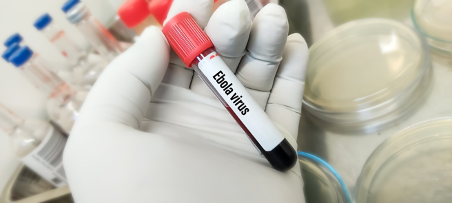 刚果宣布最近一波伊波拉疫情结束 5名病人全死。(示意图/达志影像)