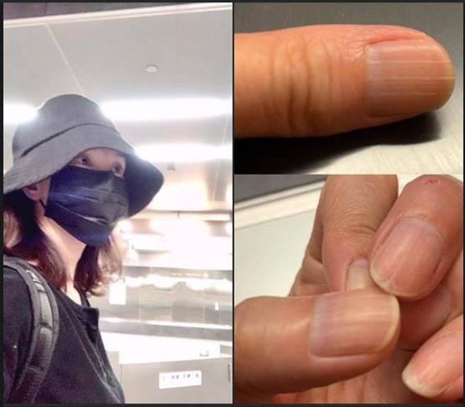 葉全真分享確診後遺症嘆傷害還是有的。（摘自葉全真臉書）