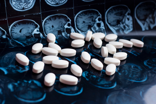 近20年來在阿茲海默症藥物的研究上也幾乎全軍覆沒，失敗率高達99.6%。目前還有120餘種潛在藥物正在進行臨床實驗中。（圖／Shutterstock)

