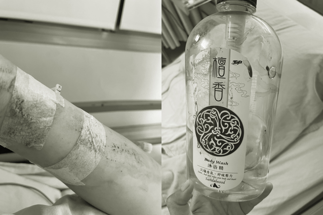 一名女網友本月4日確診入住醫院，住院第2日就遭同病房的阿姨扯下點滴、無故暴打，對方還拿她的沐浴乳當凶器痛毆她。圖片經變色處理。（翻攝自Dcard）