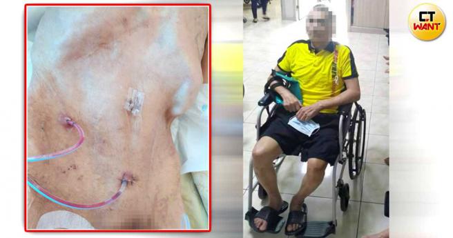 阿國父親入住慈航前還意識清醒、能說會動，在院期間卻疑似遭不當照顧，瘦成皮包骨外還滿身褥瘡。（圖／讀者提供，CTWANT合成）