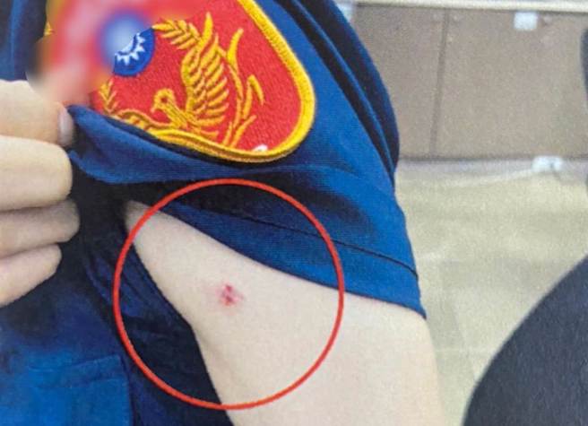 执勤员警被女子咬伤，当场将她依现行犯逮捕。(翻摄照片／林郁平台北传真）