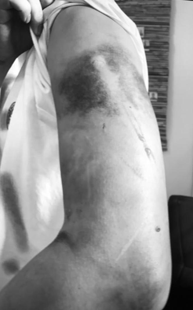 驻菲代表处表示，林姓被害人在脸书看到菲律宾线上博弈公司招聘广告，抵菲后却一直被博弈公司转卖、限制自由，甚至遭中国籍歹徒殴打受伤，6月下旬被菲国警方救出。（图/ 中央社）
