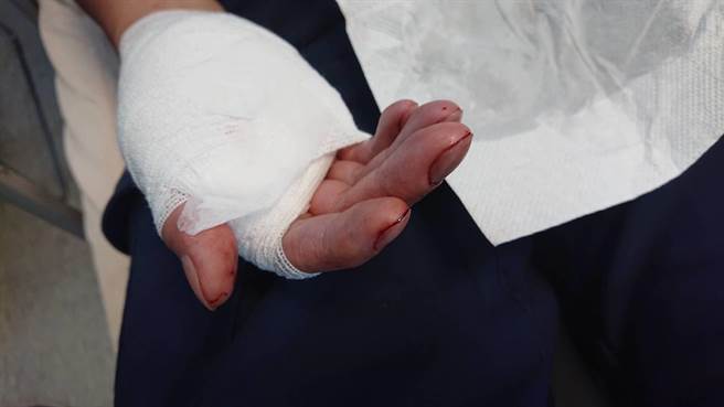 警员陈泓均受伤挂彩，被送往医院包扎。（程炳璋摄）