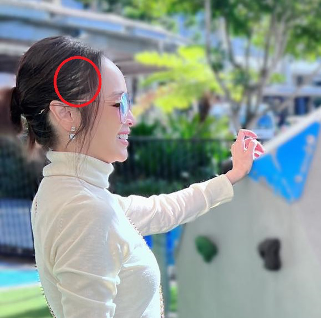 侯佩岑被网友指出头髮稀少。（图／截取自侯佩岑facebook）