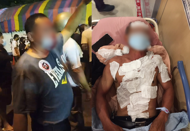 坤輿掩埋場衝突8傷，民眾全身傷曝光，2施暴黑衣人已遭逮捕送辦。(李京昇翻攝/民眾提供)