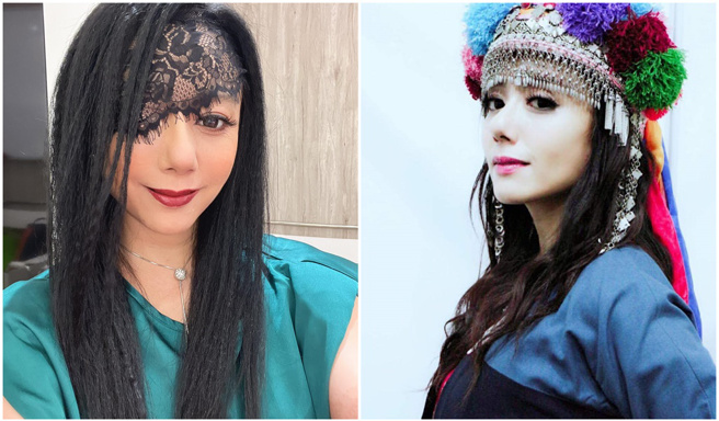 高慧君因為眼疾問題，已經一年沒戲可拍收入掛零。(高慧君 Tanivu Yatauyungan臉書)