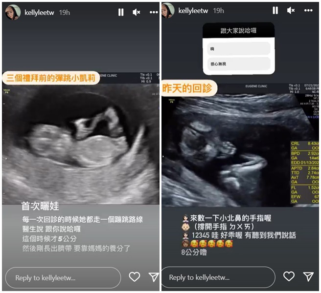 Kelly在限动公开前后2次产检的超音波画面。（图／翻摄自kellyleetw IG）