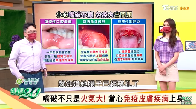 江俊坤分享案例，一名30多岁女性长期嘴破又肚痛，检查后发现患有罕见疾病。（图／翻摄自《健康2.0》）
