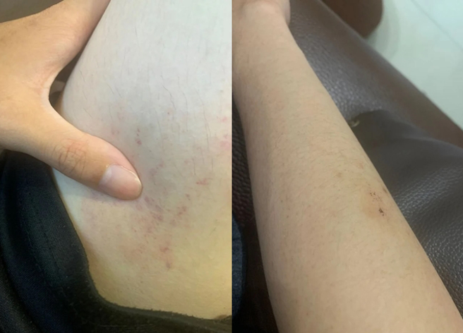 人妻因為每次和老公嘿咻後，自己常「遍體麟傷」，導致她萌生離婚念頭。（翻攝自Dcard）