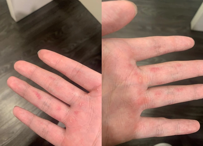 人妻因為每次和老公嘿咻後，自己常「遍體麟傷」，導致她萌生離婚念頭。（翻攝自Dcard）