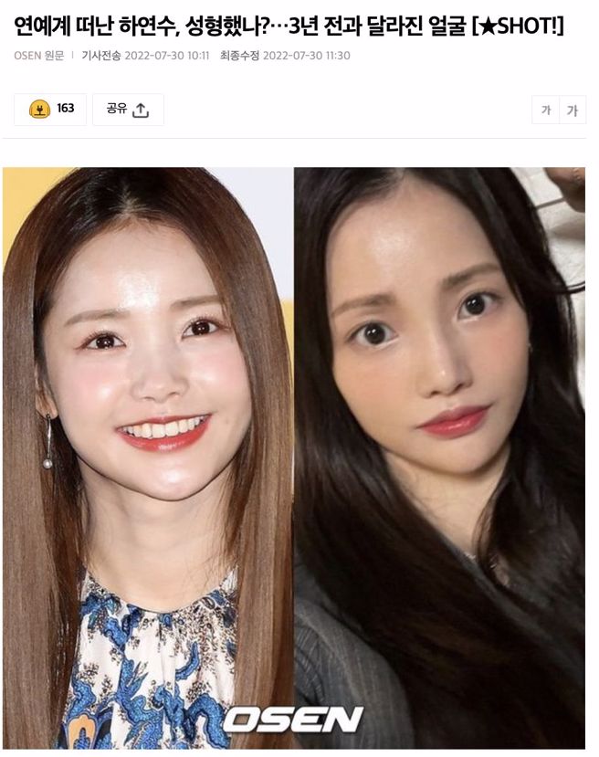 夏沇秀遭疑整形让她忍不住跳出来怒轰记者。（图／OSEN）