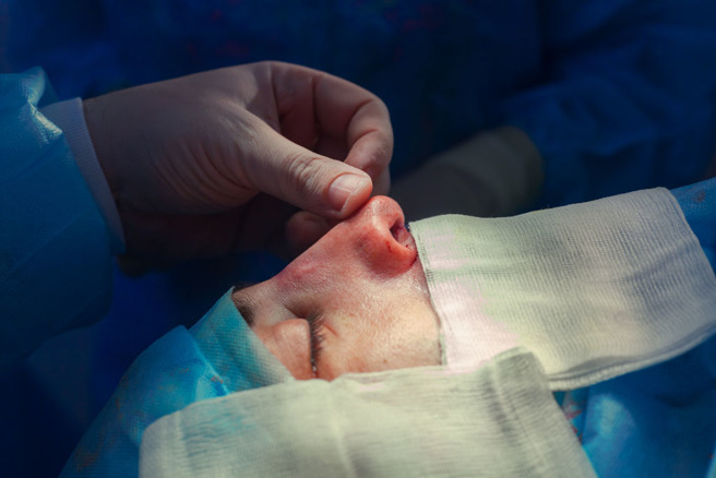 巴西一名男子看YouTube影片，自行在家隆鼻，还使用强力胶黏合伤口，最终因严重感染送医救治。（示意图／达志影像）