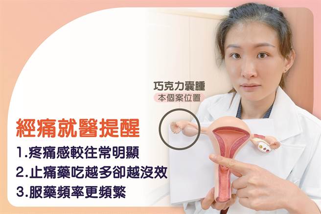 黄闵暄医师提醒经痛就医的注意事项。(台中慈济医院提供)