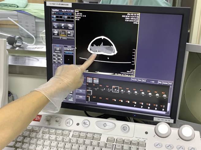 为食蛇龟断层扫描，竹山秀传医院头一遭。（竹山秀传提供／廖志晃南投传真）