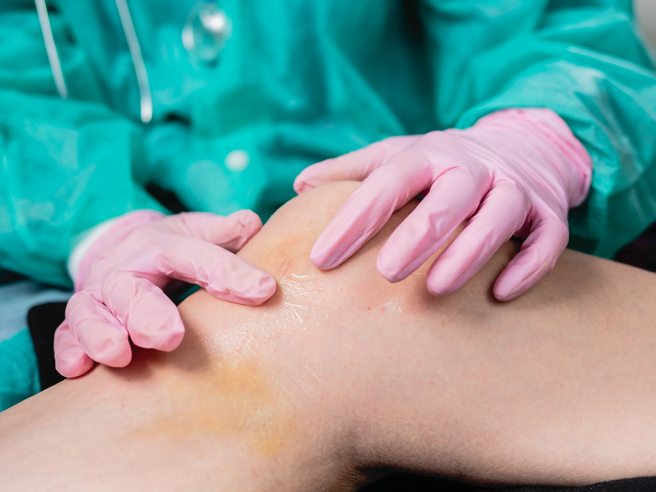 对于一般民眾而言，局部麻醉药似乎就仅是舒缓疼痛，但医师表示，麻醉药远比想像中复杂许多。（示意图／Shutterstock）