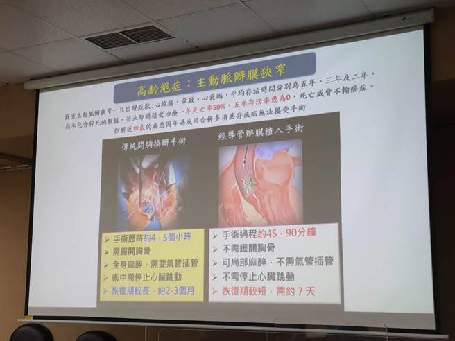 经导管心臟瓣膜植入术与传统开胸手术比较。（陈人齐摄）