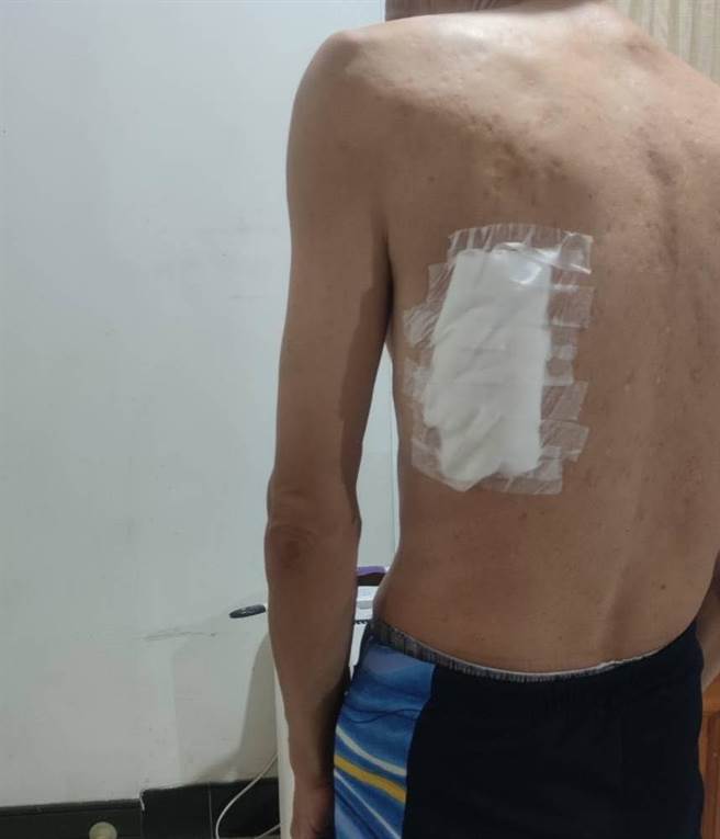 家属遭李男持棍殴打。（民眾提供）